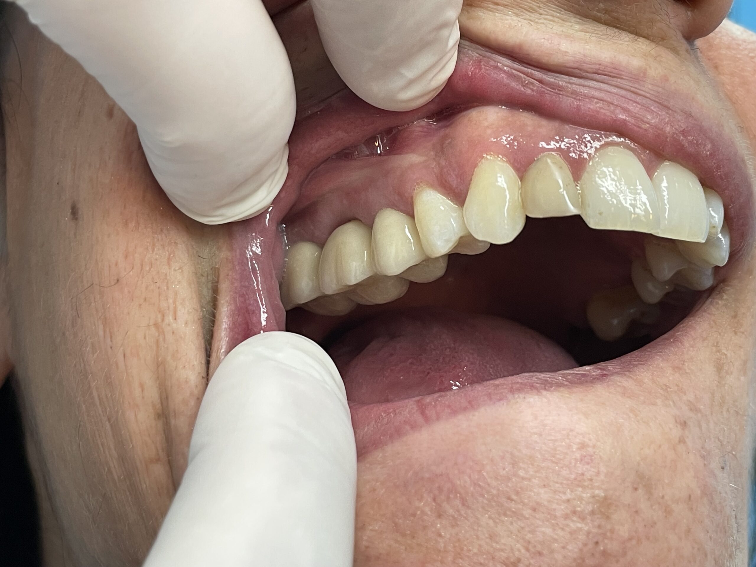 Laboratorio Odontotecnico Napoli, Clinica Dentale Napoli, CED Napoli