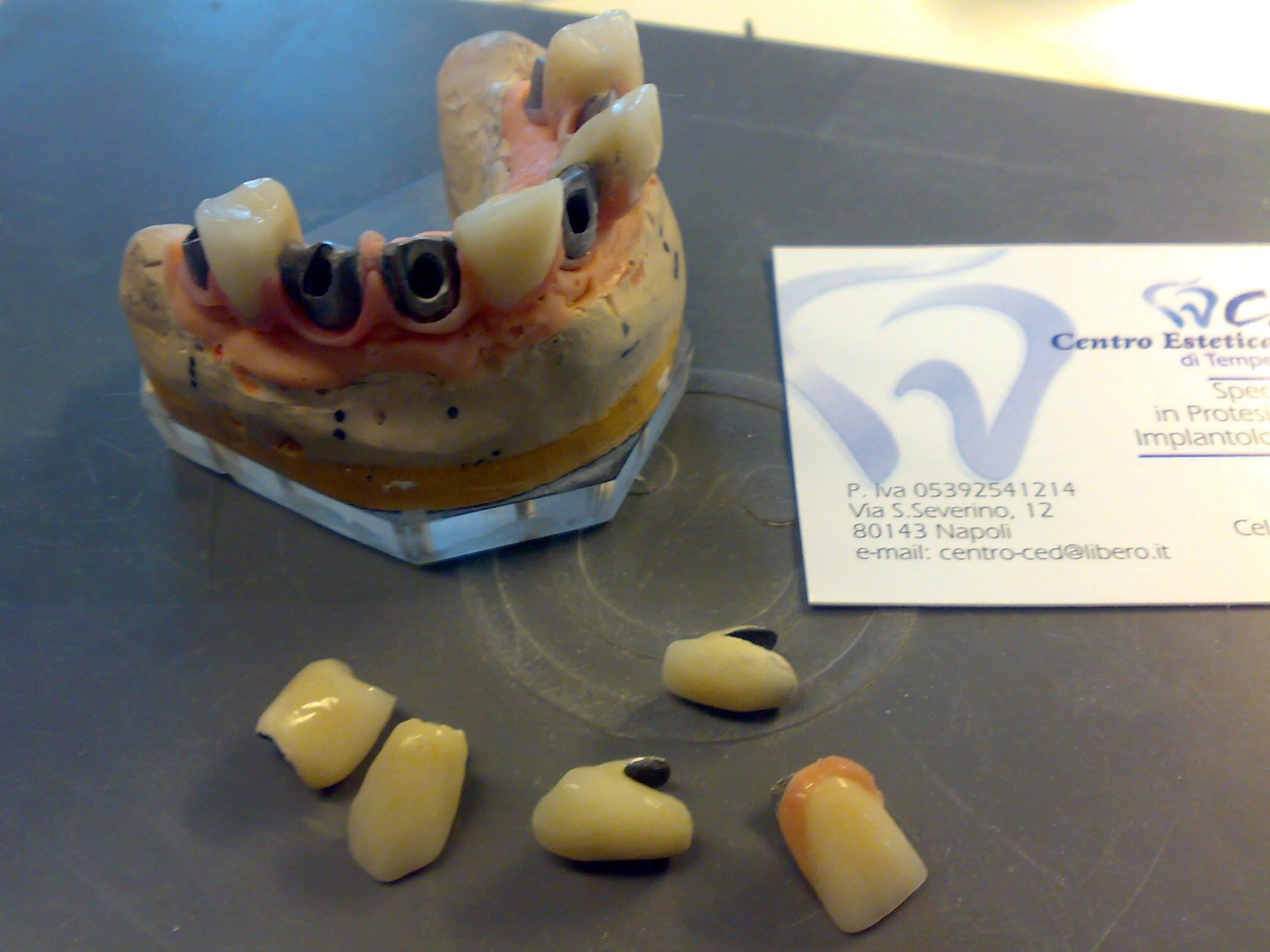 Laboratorio Odontotecnico Napoli, Clinica Dentale Napoli, CED Napoli