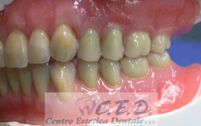 Laboratorio Odontotecnico Napoli, Clinica Dentale Napoli, CED Napoli