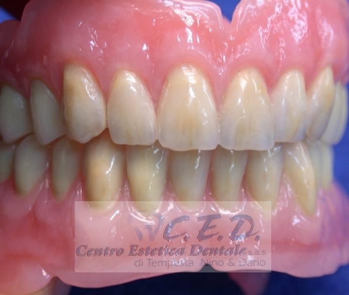 Laboratorio Odontotecnico Napoli, Clinica Dentale Napoli, CED Napoli